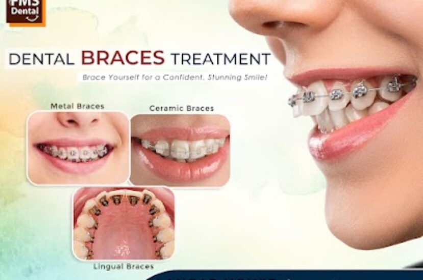Best Orthodontist in Langar House – Premier Braces and Orthodontic Care